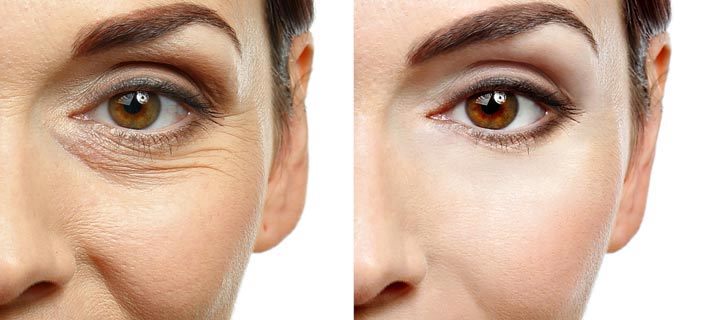 Magnesium and Wrinkle Reduction